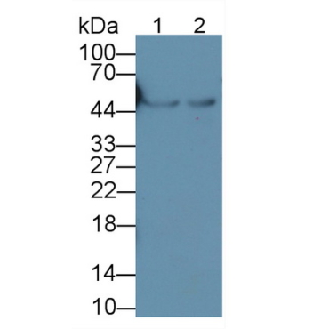 Glial Fibrillary Acidic Protein (GFAP) Mouse Monoclonal Antibody