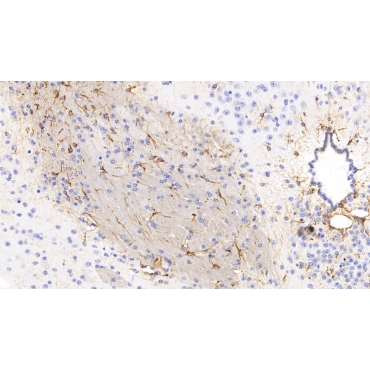 Glial Fibrillary Acidic Protein (GFAP) Mouse Monoclonal Antibody
