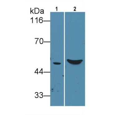 Glial Fibrillary Acidic Protein (GFAP) Mouse Monoclonal Antibody