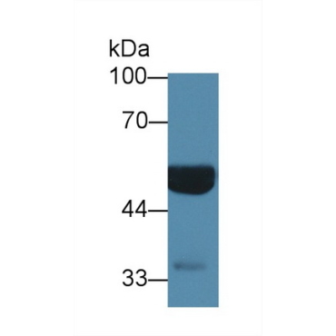 Glial Fibrillary Acidic Protein (GFAP) Mouse Monoclonal Antibody