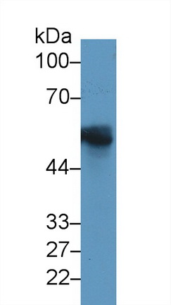 Glial Fibrillary Acidic Protein (GFAP) Rat Monoclonal Antibody