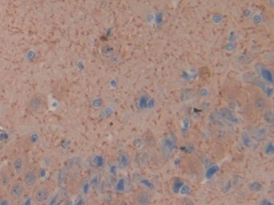 Glial Fibrillary Acidic Protein (GFAP) Rat Monoclonal Antibody