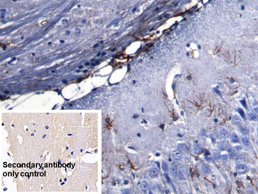 Glial Fibrillary Acidic Protein (GFAP) Rat Monoclonal Antibody
