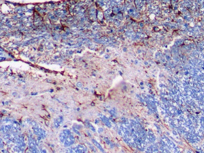 Glial Fibrillary Acidic Protein (GFAP) Rat Monoclonal Antibody