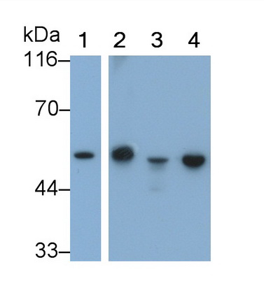 Glial Fibrillary Acidic Protein (GFAP) Rat Monoclonal Antibody