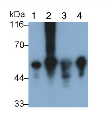 Glial Fibrillary Acidic Protein (GFAP) Rat Monoclonal Antibody