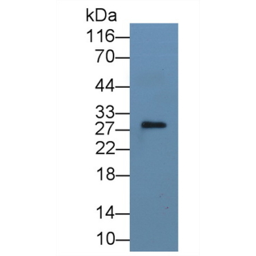 Interleukin 1 Alpha (IL1a) Human Monoclonal Antibody