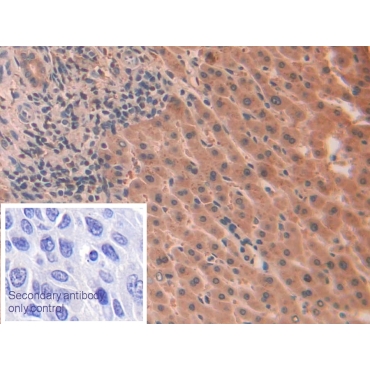 Interleukin 1 Alpha (IL1a) Human Monoclonal Antibody