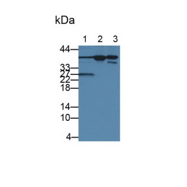 Interleukin 1 Alpha (IL1a) Human Monoclonal Antibody