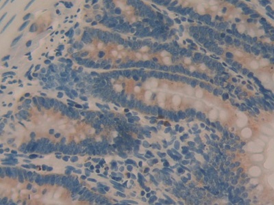 Interleukin 1 Alpha (IL1a) Rat Monoclonal Antibody