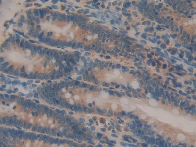 Interleukin 1 Alpha (IL1a) Rat Monoclonal Antibody