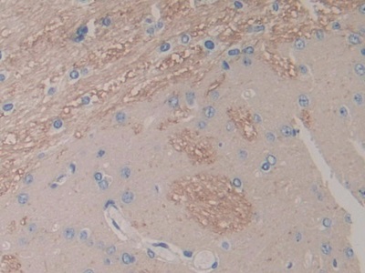 Interleukin 1 Alpha (IL1a) Rat Monoclonal Antibody