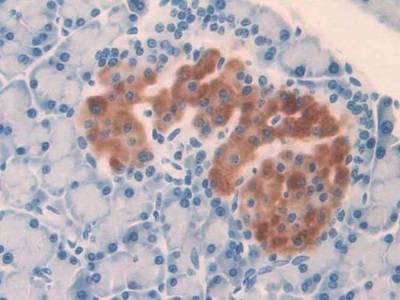 Interleukin 1 Alpha (IL1a) Rat Monoclonal Antibody
