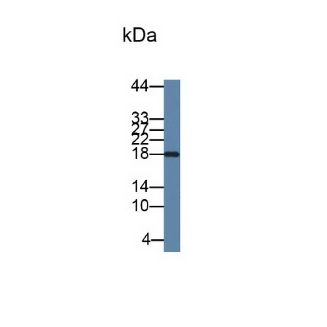 Interleukin 2 (IL2) Human Monoclonal Antibody