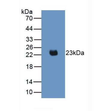 Interleukin 2 (IL2) Mouse Monoclonal Antibody