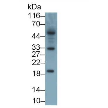Interleukin 2 (IL2) Mouse Monoclonal Antibody