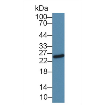 Immunoglobulin G1 (IgG1) Human Monoclonal Antibody