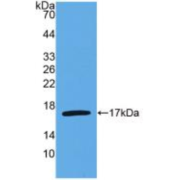 Interleukin 4 (IL4) Human Monoclonal Antibody