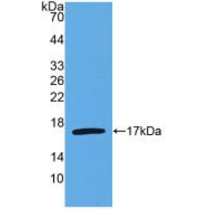 Interleukin 4 (IL4) Human Monoclonal Antibody