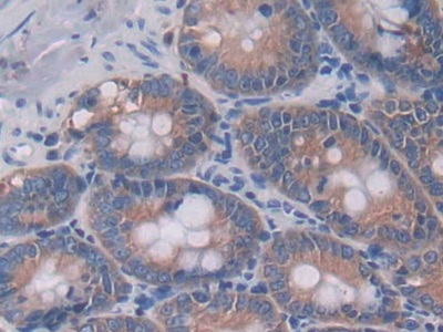 Interleukin 4 (IL4) Rat Monoclonal Antibody