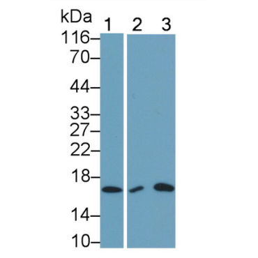 Interleukin 5 (IL5) Human Monoclonal Antibody