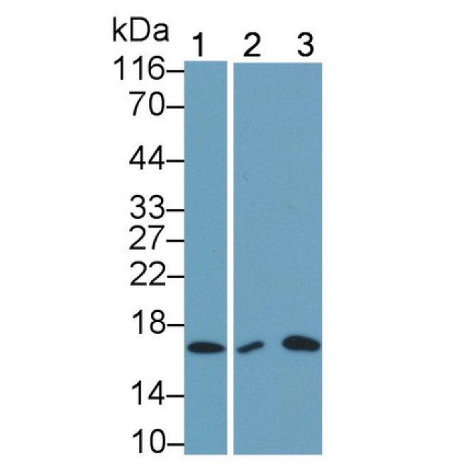 Interleukin 5 (IL5) Human Monoclonal Antibody