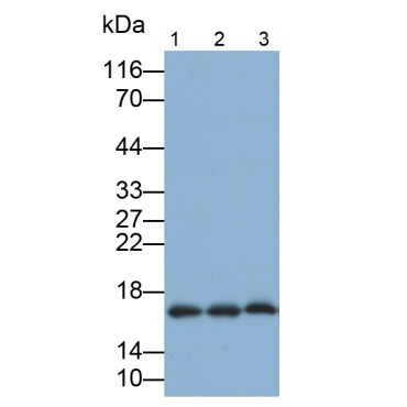 Interleukin 5 (IL5) Human Monoclonal Antibody