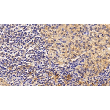 Interleukin 6 (IL6) Human Monoclonal Antibody