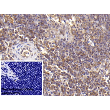 Interleukin 6 (IL6) Human Monoclonal Antibody
