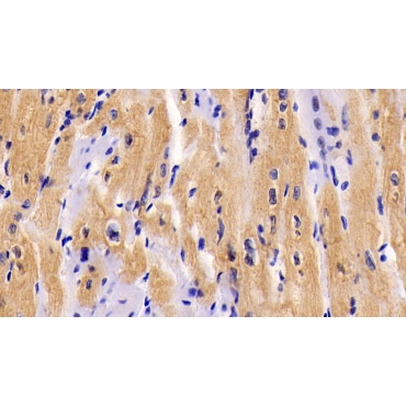 Interleukin 6 (IL6) Human Monoclonal Antibody