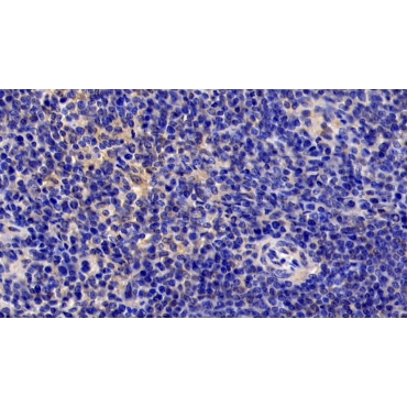 Interleukin 6 (IL6) Human Monoclonal Antibody