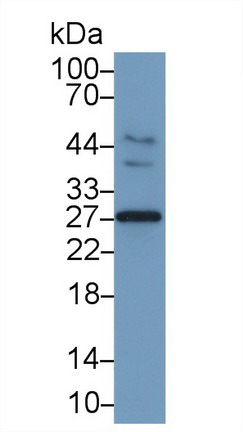 Interleukin 6 (IL6) Rabbit Monoclonal Antibody