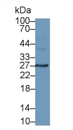Interleukin 6 (IL6) Rabbit Monoclonal Antibody
