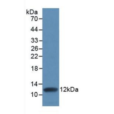 Interleukin 8 (IL8) Human Monoclonal Antibody