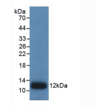 Interleukin 8 (IL8) Human Monoclonal Antibody