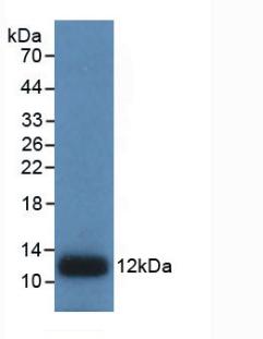 Interleukin 8 (IL8) Human Monoclonal Antibody