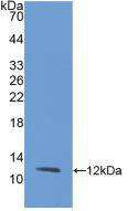 Interleukin 8 (IL8) Rabbit Monoclonal Antibody