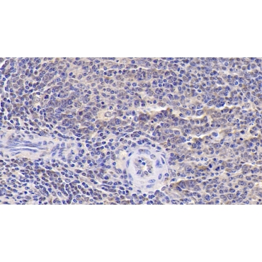 Interleukin 9 (IL9) Human Monoclonal Antibody