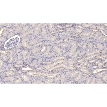 Interleukin 9 (IL9) Human Monoclonal Antibody