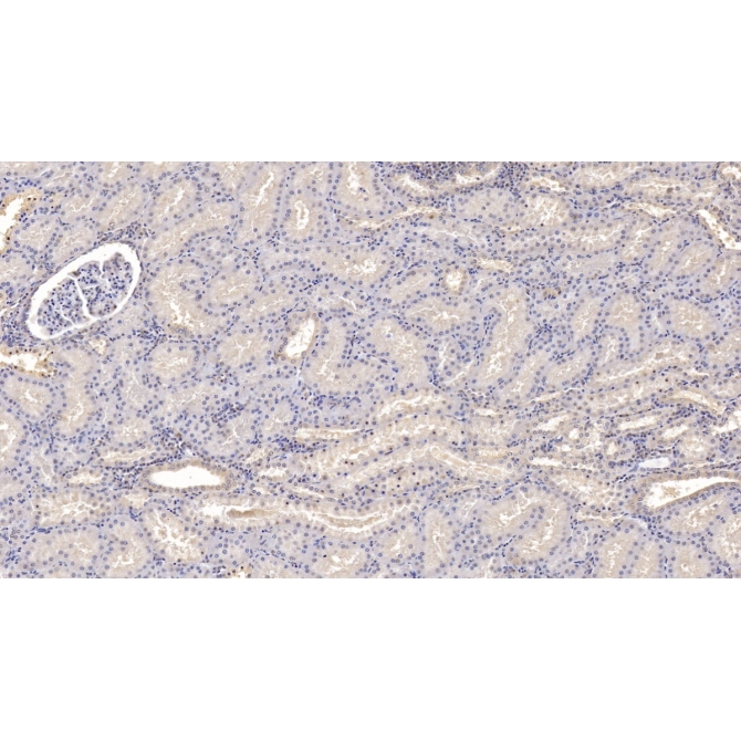 Interleukin 9 (IL9) Human Monoclonal Antibody