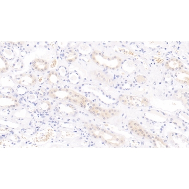 Interleukin 9 (IL9) Human Monoclonal Antibody