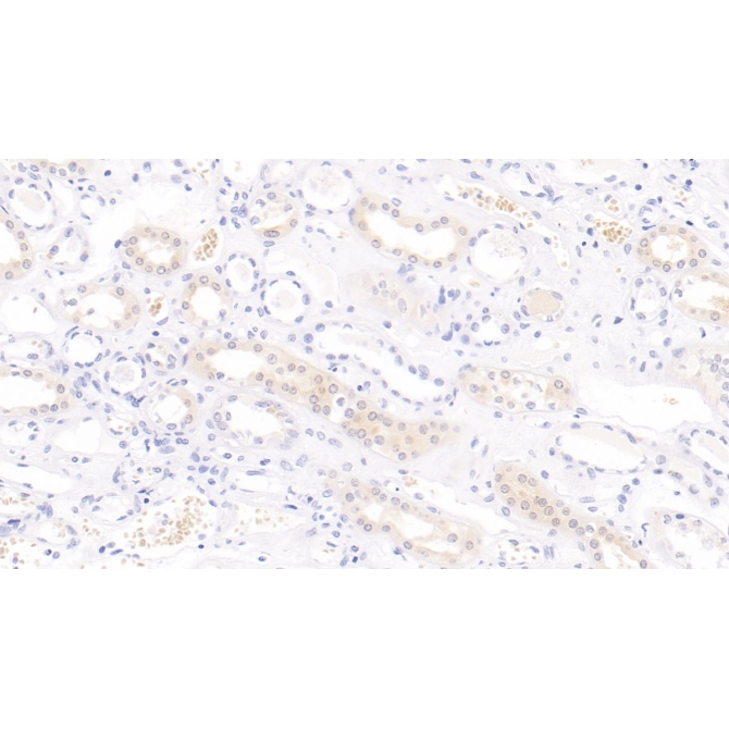 Interleukin 9 (IL9) Human Monoclonal Antibody