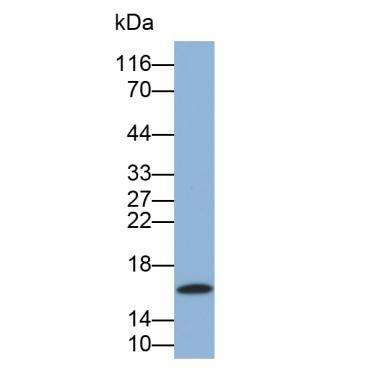 Leptin (LEP) Human Monoclonal Antibody