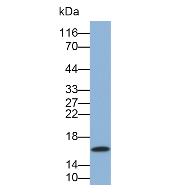 Leptin (LEP) Human Monoclonal Antibody