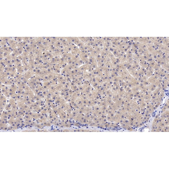 Leptin (LEP) Human Monoclonal Antibody