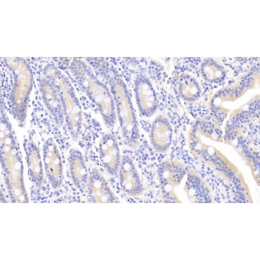 Leukemia Inhibitory Factor (LIF) Human Monoclonal Antibody
