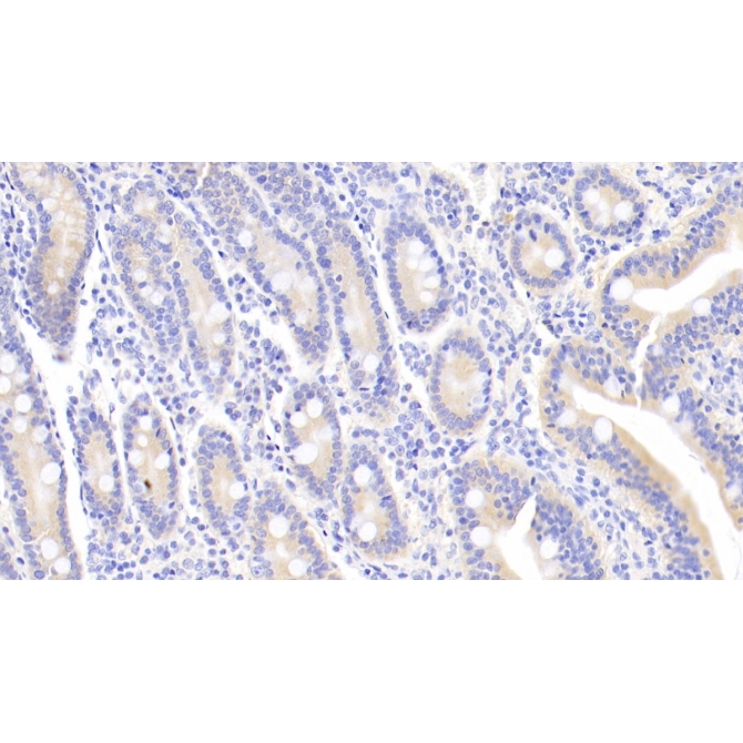 Leukemia Inhibitory Factor (LIF) Human Monoclonal Antibody