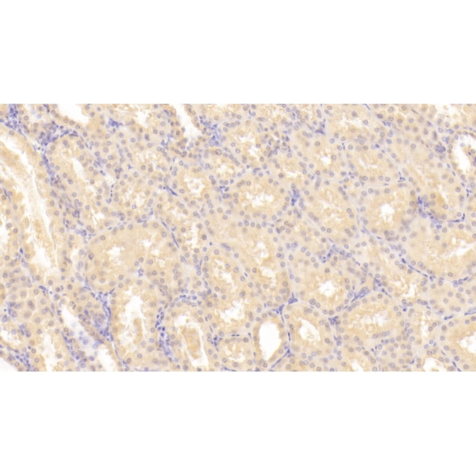Leukemia Inhibitory Factor (LIF) Human Monoclonal Antibody