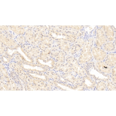 Leukemia Inhibitory Factor (LIF) Human Monoclonal Antibody