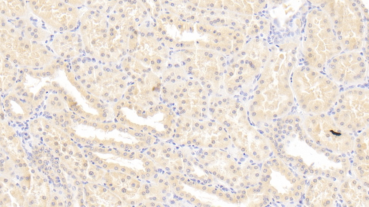 Leukemia Inhibitory Factor (LIF) Human Monoclonal Antibody